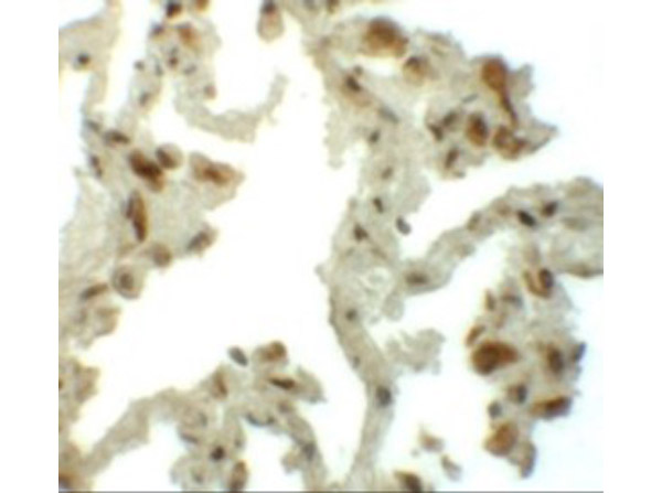 Immunohistochemistry of TM4SF1