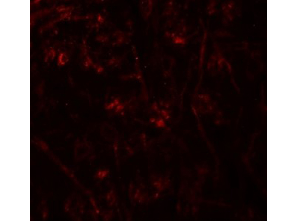 Immunofluorescence of TMEM106A