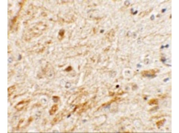 Immunohistochemistry of TMEM106A
