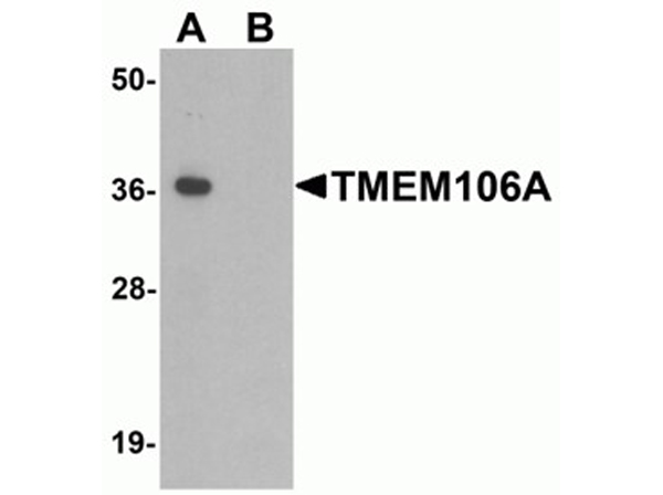 Western blot analysis of TMEM106A
