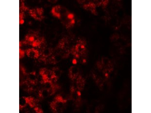 Immunofluorescence of TMEM106B