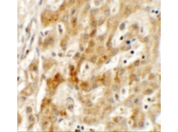 Immunohistochemistry of TMEM106B