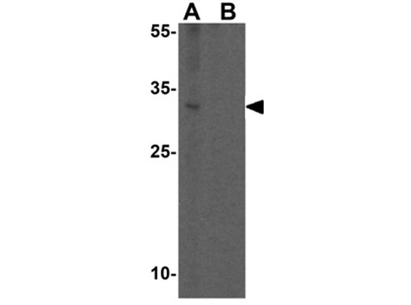 Western blot analysis of TMEM106B