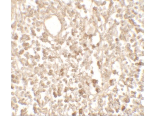 Immunohistochemistry of TMEM107