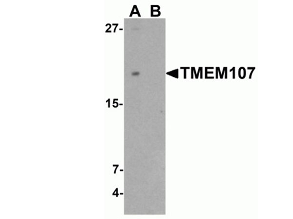 Western blot of TMEM107
