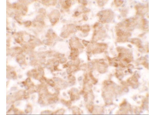 Immunohistochemistry of TMEM135