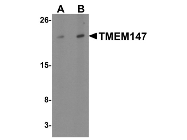 Western blot analysis of TMEM147