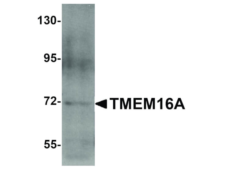 Western Blot of TMEM16A Antibody