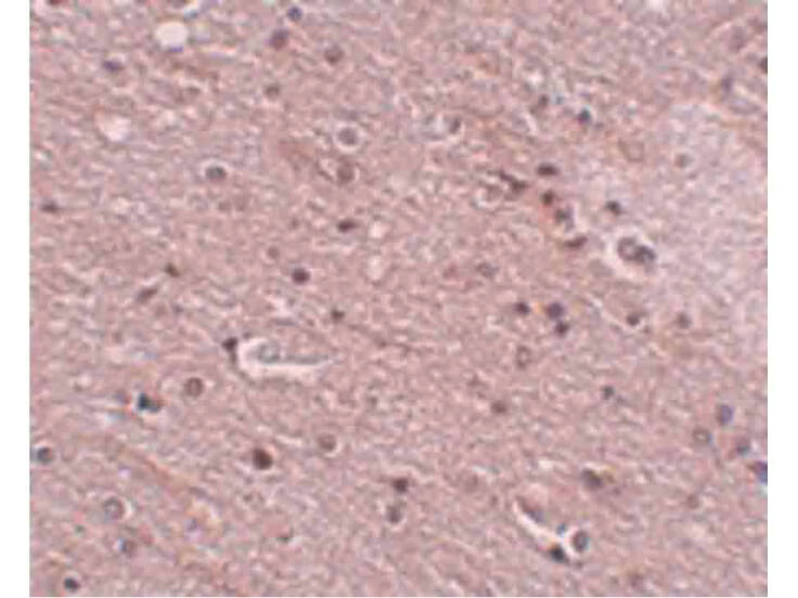 Immunohistochemistry of TMEM16B Antibody