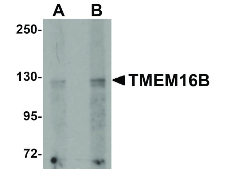 Western Blot of TMEM16B Antibody