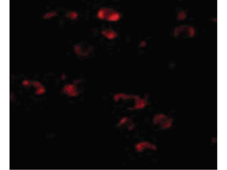 Immunofluorescence of TMEM18 Antibody