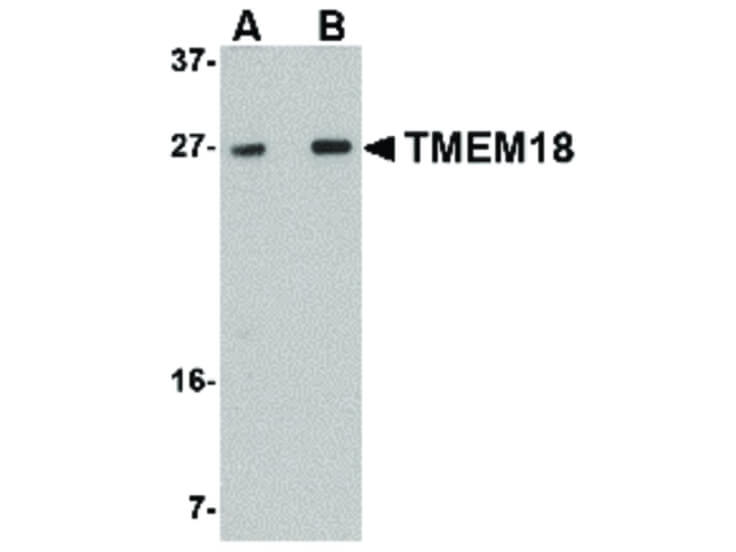 Western Blot of TMEM18 Antibody