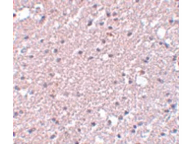 Immunohistochemistry of TMEM184A Antibody