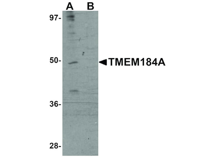 Western Blot of TMEM184A Antibody