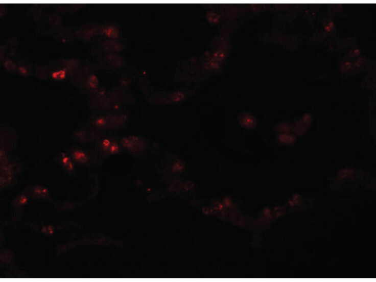 Immunofluorescence of TMEM184B Antibody