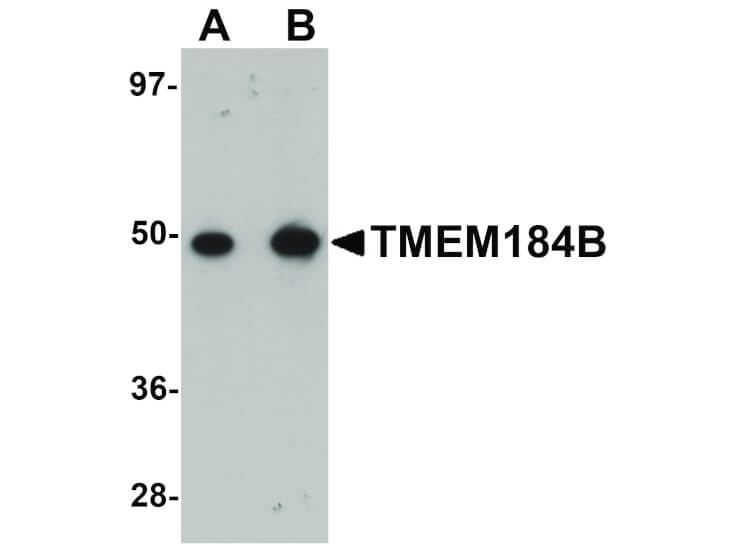 Western Blot of TMEM184B Antibody