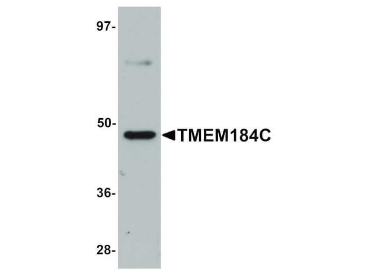 Western Blot of TMEM184C Antibody