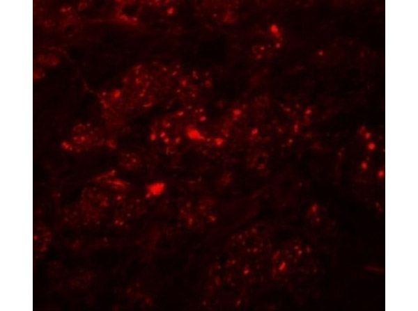 Immunofluorescence of TMEM192