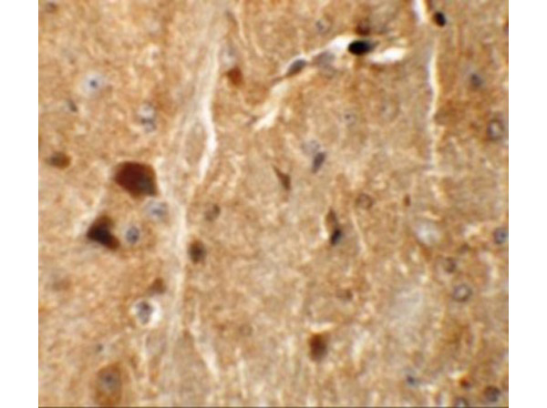 Immunohistochemistry of TMEM192