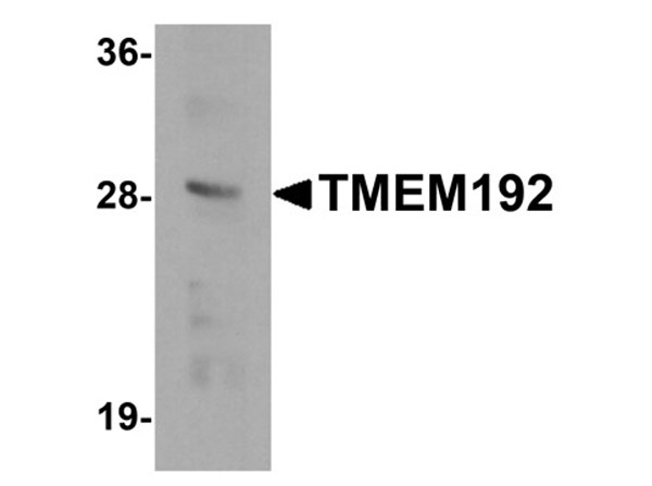 Western blot analysis of TMEM192