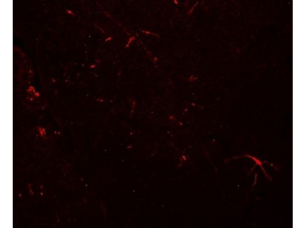 Immunofluorescence of TMEM204