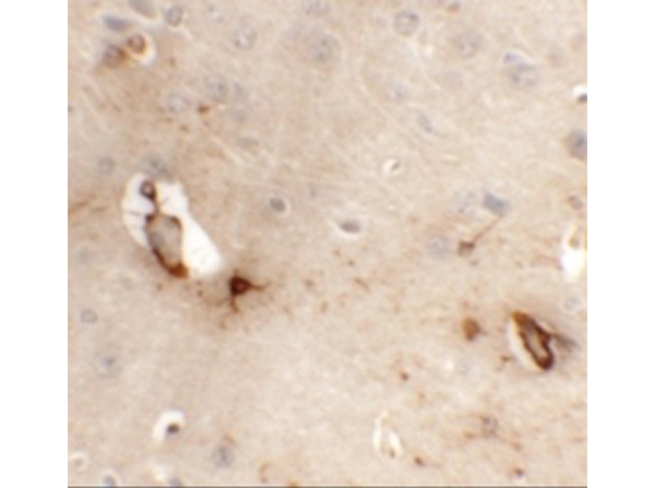 Immunohistochemistry of TMEM204