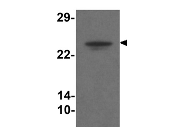 Western blot analysis of TMEM204.