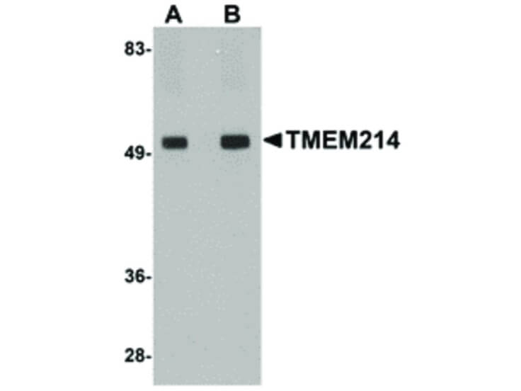 Western Blot of TMEM214 Antibody
