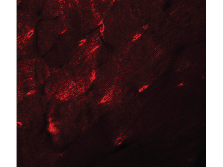 Immunofluorescence of TMEM38A Antibody