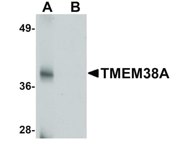 Western Blot of TMEM38A Antibody