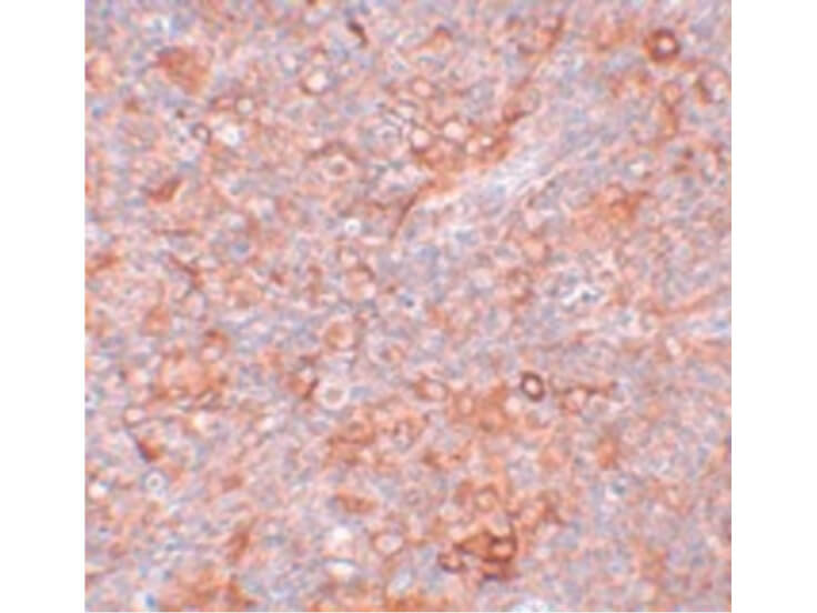 Immunohistochemistry of TMEM38B Antibody