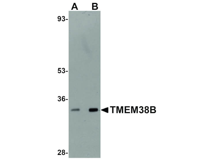 Western Blot of TMEM38B Antibody