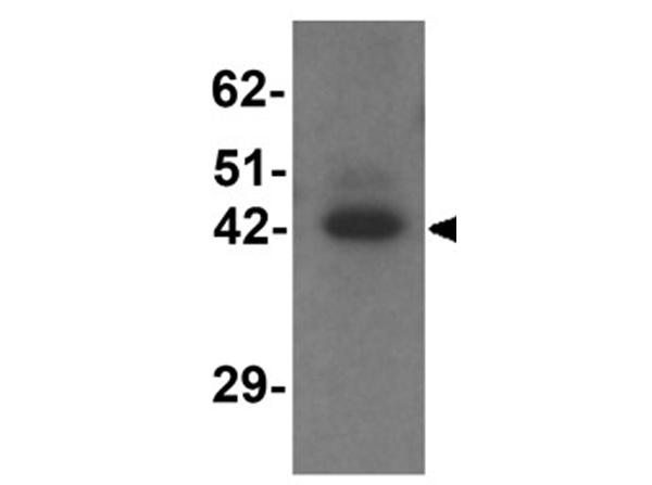 Western blot analysis of TMEM59L