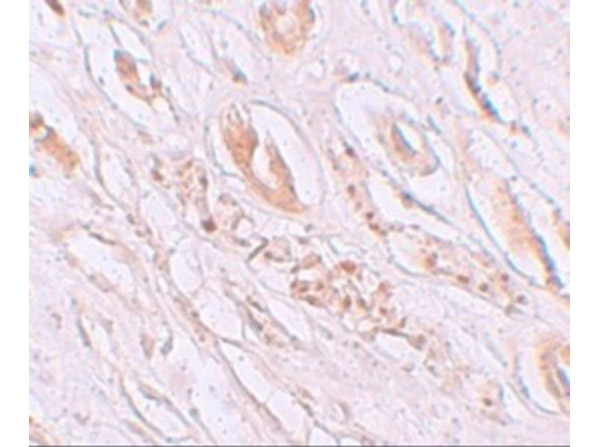 Immunohistochemistry of TMEM59