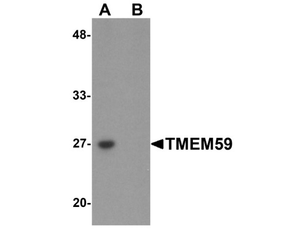 Western blot of TMEM59