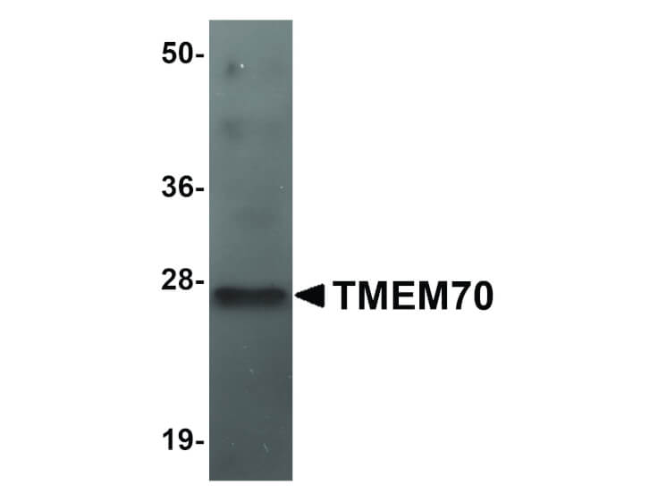 Western Blot of TMEM70 Antibody