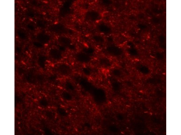 Immunofluorescence of TMEM88