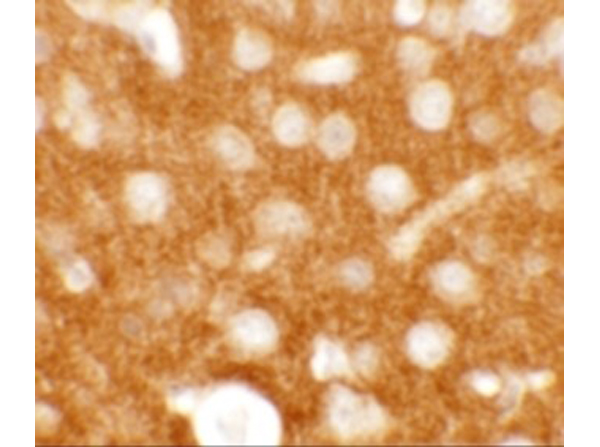 Immunohistochemistry of TMEM88