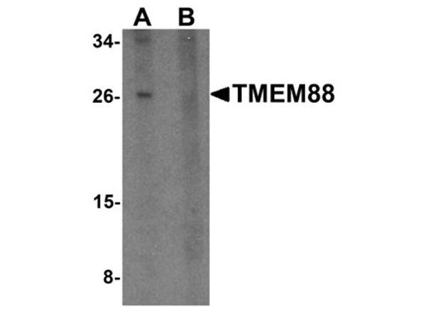 Western blot analysis of TMEM88