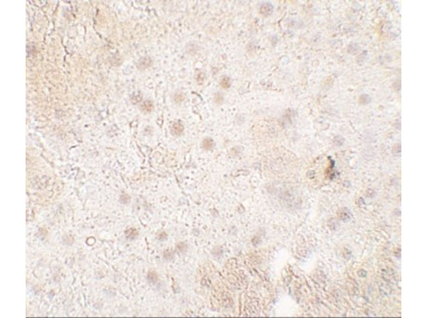 Immunofluorescence of TMIGD1