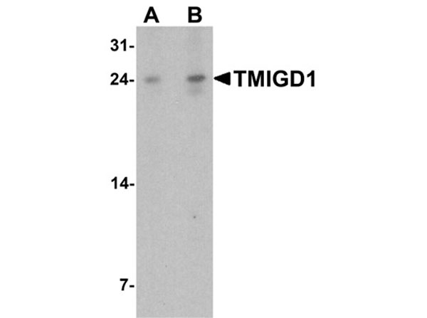 Western blot of TMIGD1