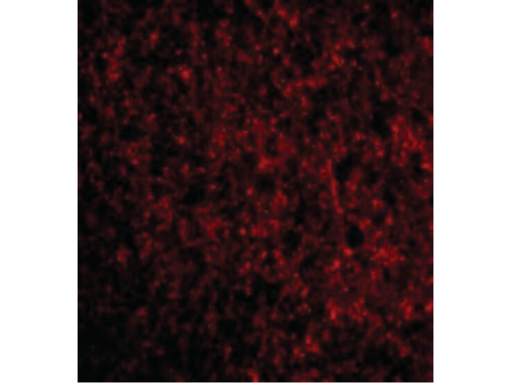Immunofluorescence of TMP21 Antibody