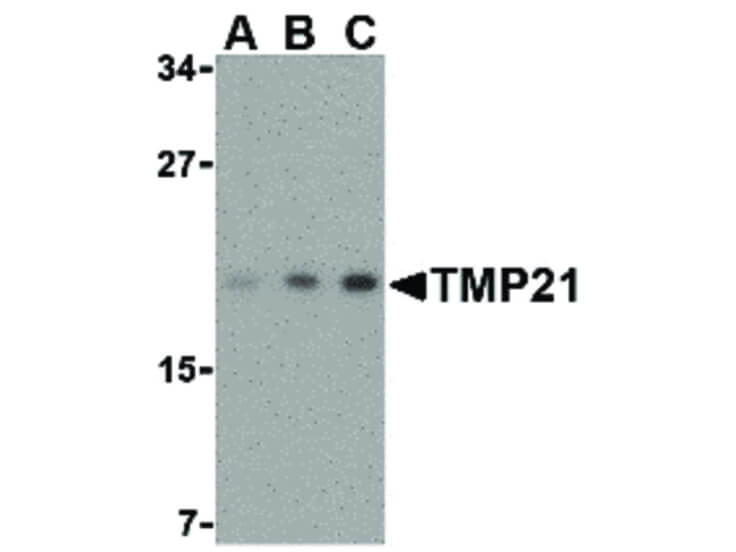 Western Blot of TMP21 Antibody