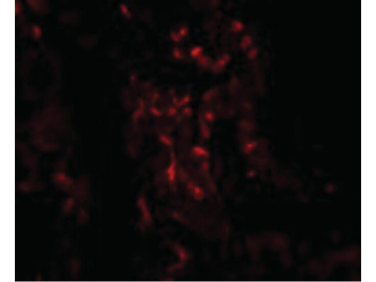 Immunofluorescence of TNFAIP3 Antibody