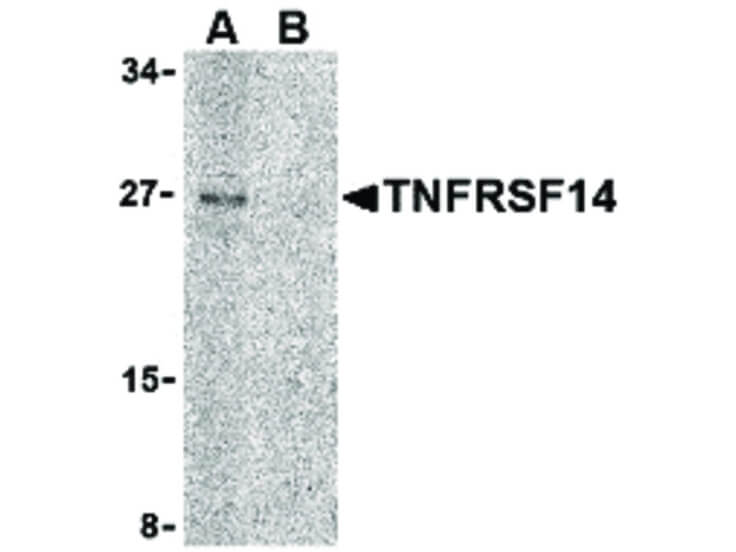 Western Blot of TNFRSF14 Antibody