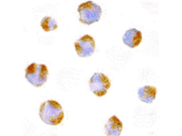 Immunocytochemistry of TNFRSF14 Antibody