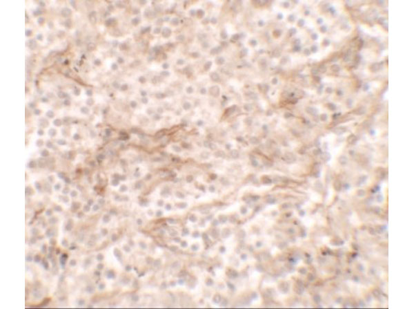Immunohistochemistry of TNFSF4