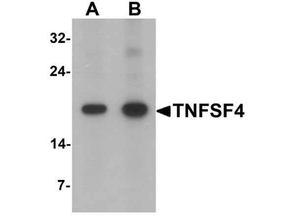 Western blot analysis of TNFSF4