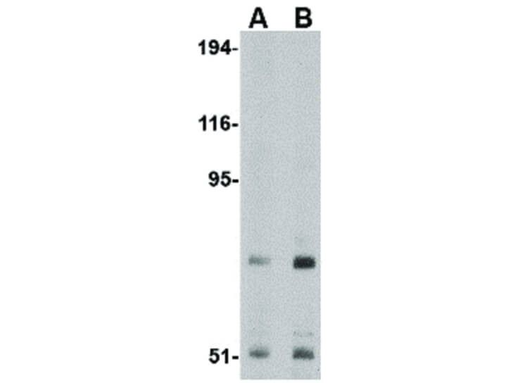 Western Blot of TNPO3 Antibody