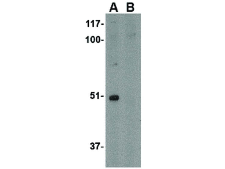 Western Blot of TOCA-1 Antibody